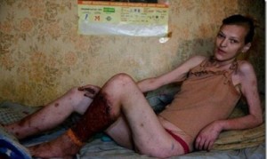 Krokodil-massima-allerta-anche-in-Italia-sulla-droga-killer_h_partb